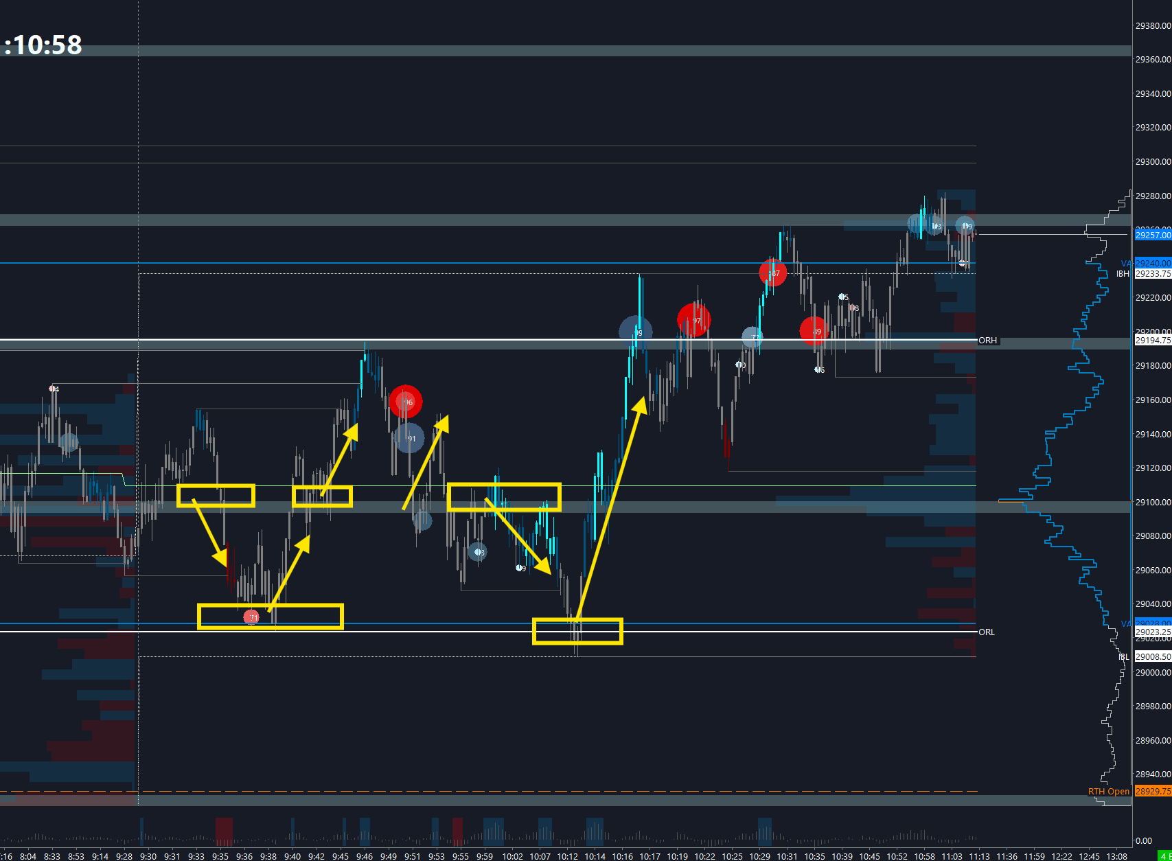 NQ trade setups — defined trade levels on the volume profile